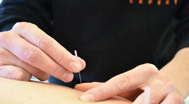 Dry Needling